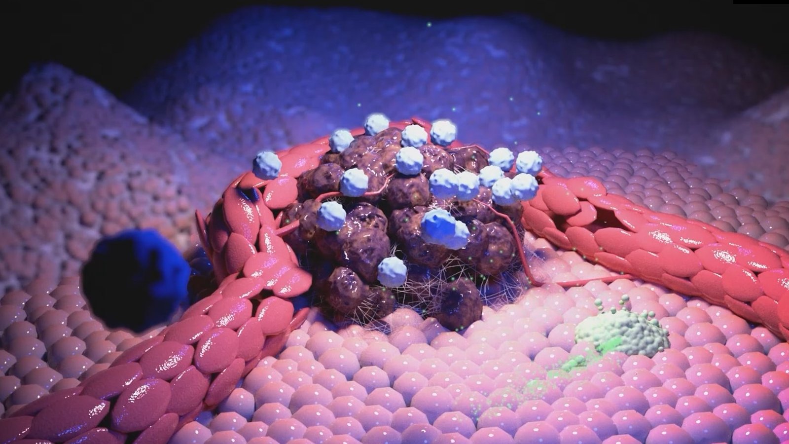 Medical Animation - UThink Med Visuals